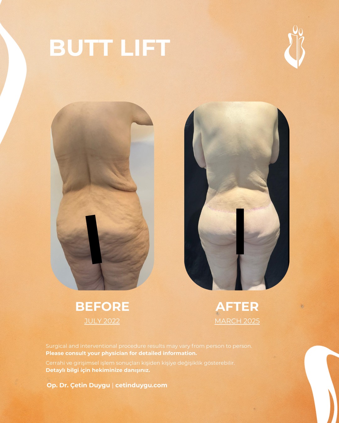 WhatsApp Image 2026-01-17 at 17.32.45