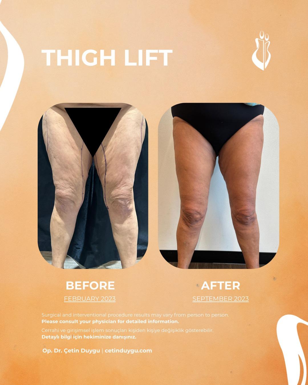 WhatsApp Image 2026-01-17 at 17.33.47 (2)