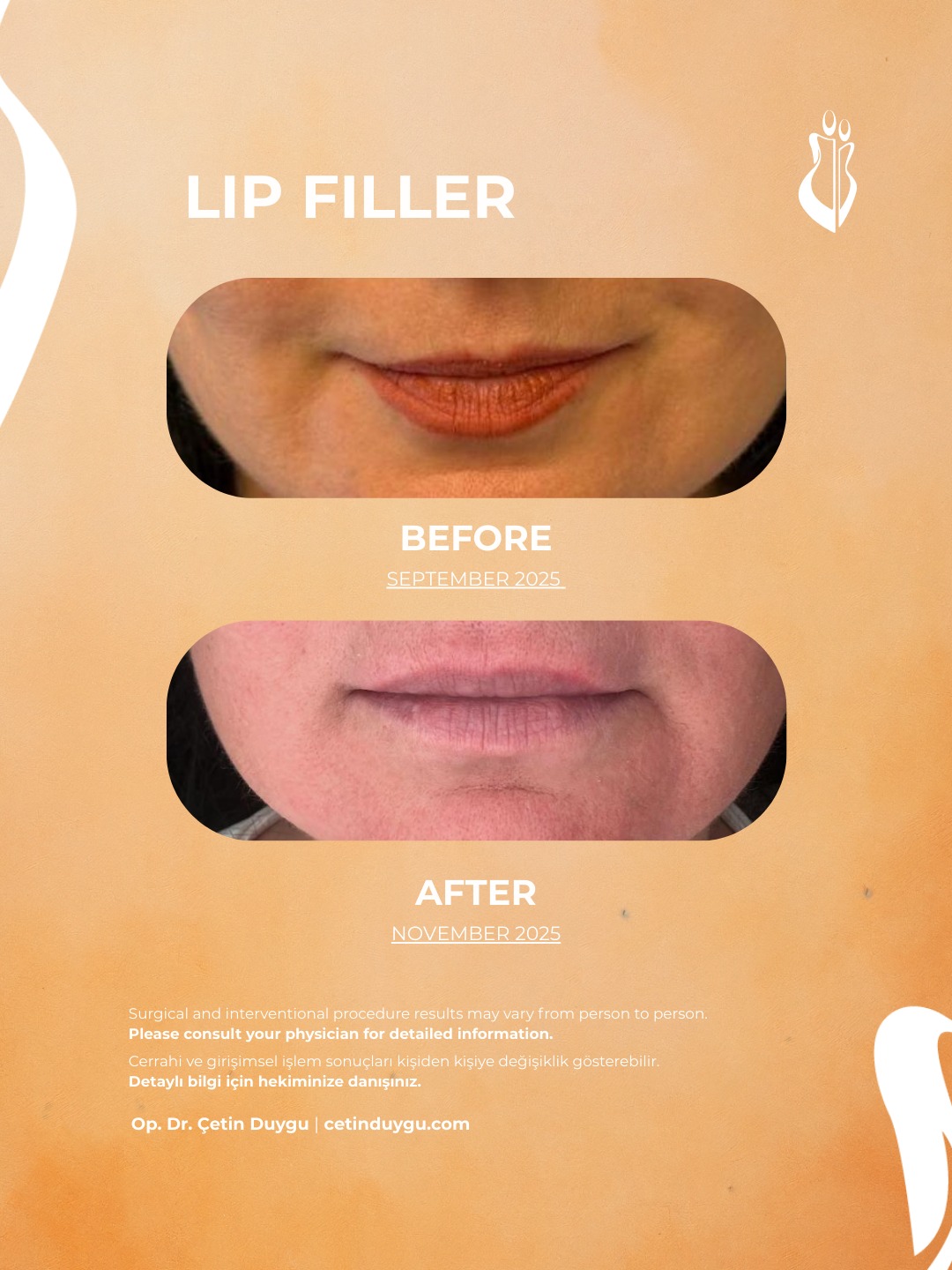 WhatsApp Image 2026-01-27 at 22.20.00 (4)