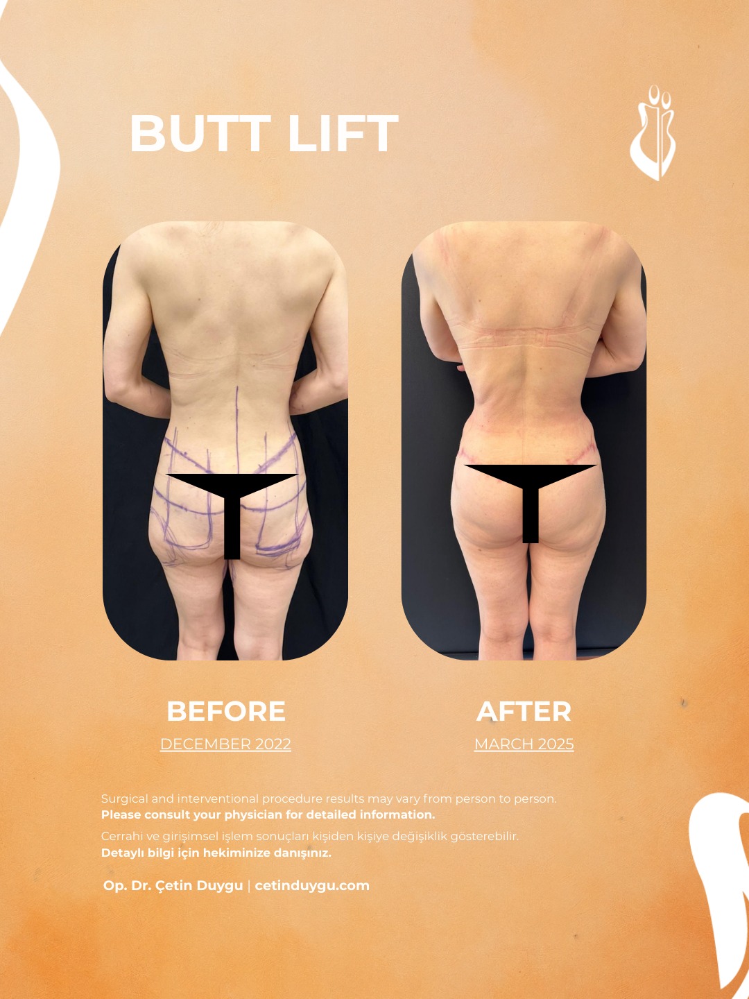 WhatsApp Image 2026-01-27 at 22.20.01 (4)