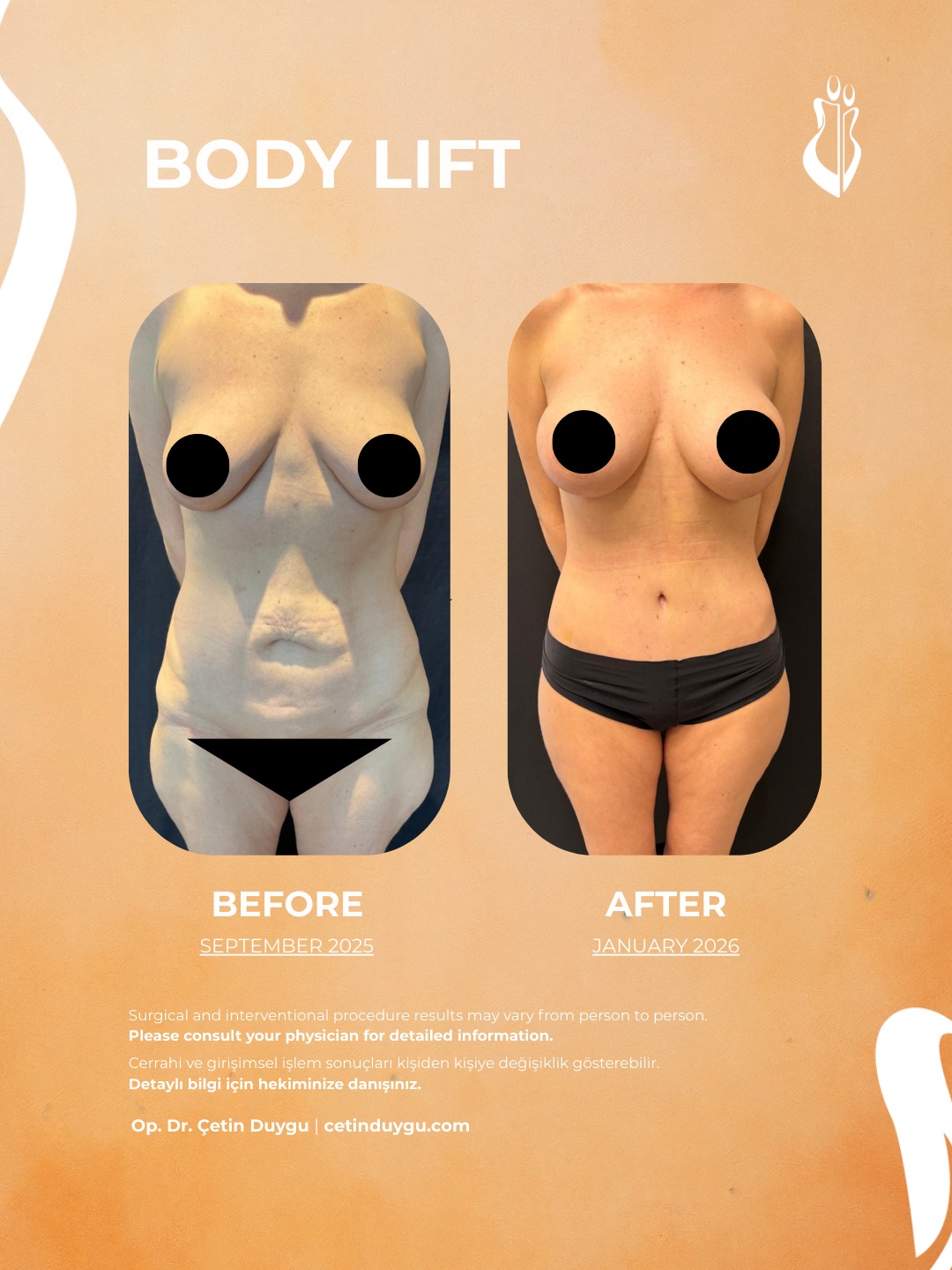 WhatsApp Image 2026-01-31 at 00.12.32