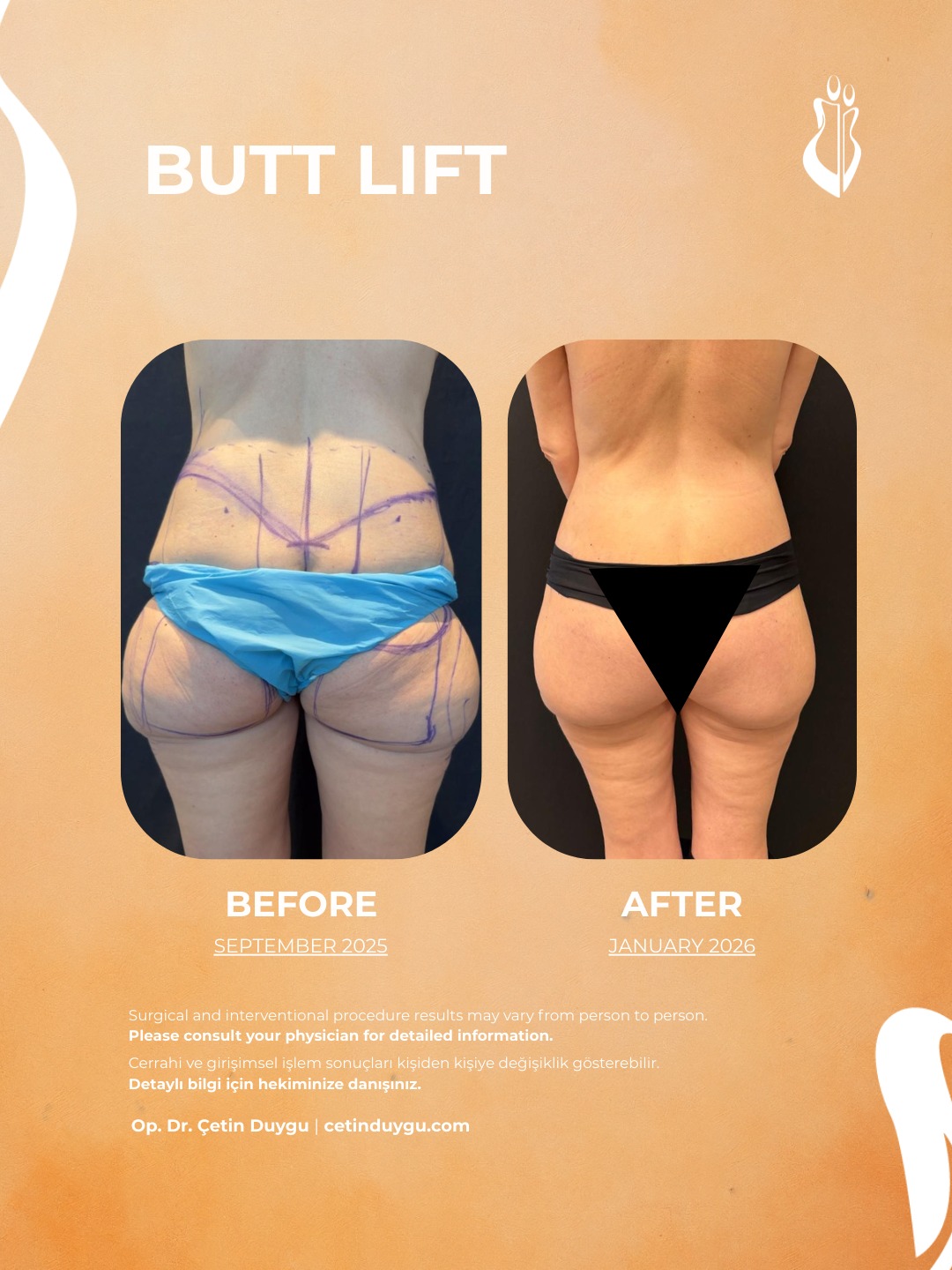 WhatsApp Image 2026-01-31 at 00.12.33