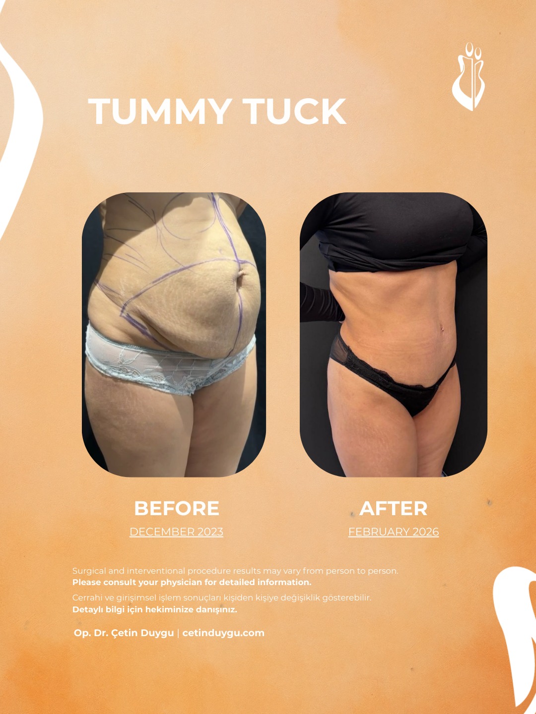 WhatsApp Image 2026-02-09 at 17.59.30 (1)