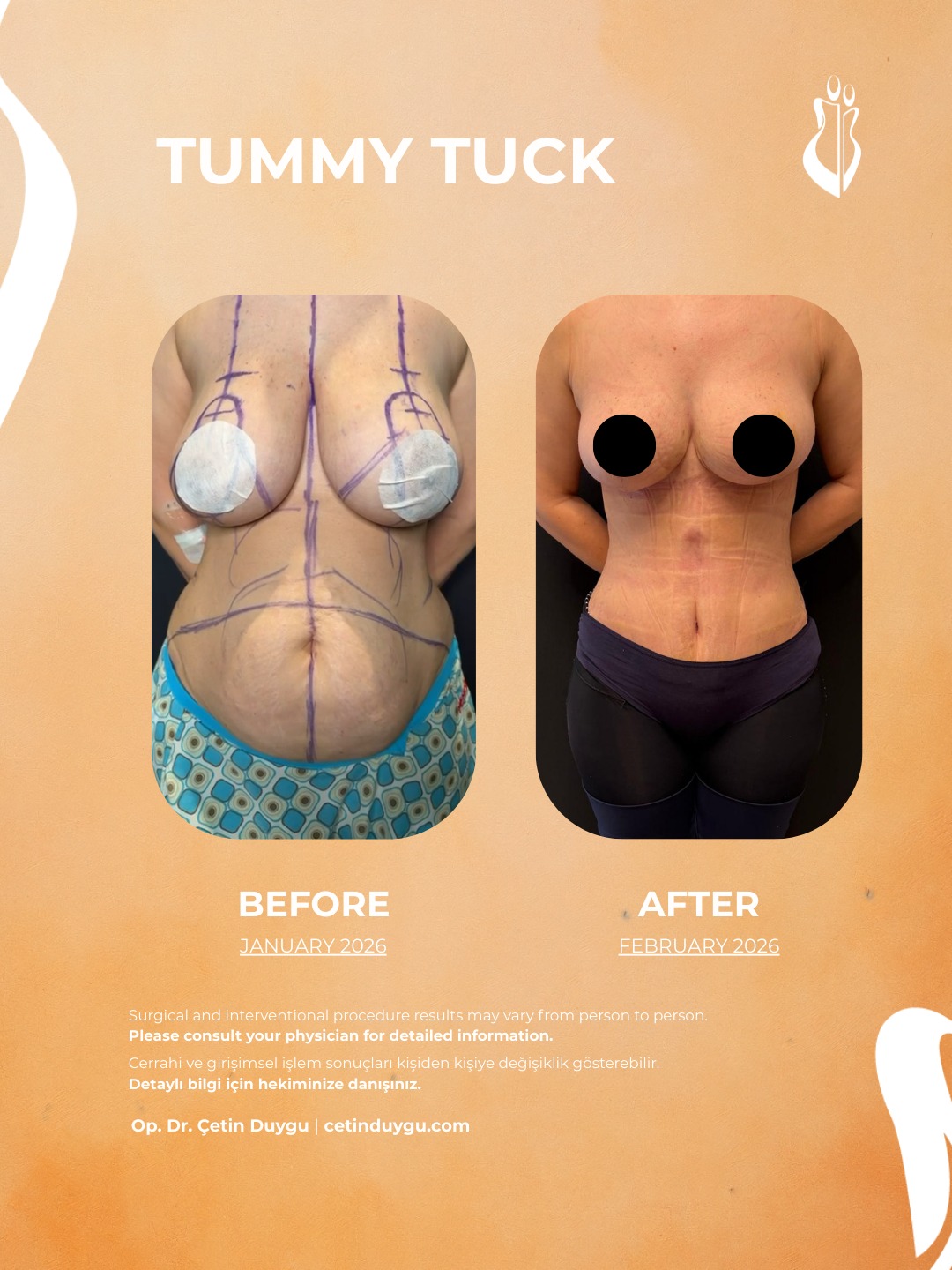 WhatsApp Image 2026-02-09 at 17.59.31