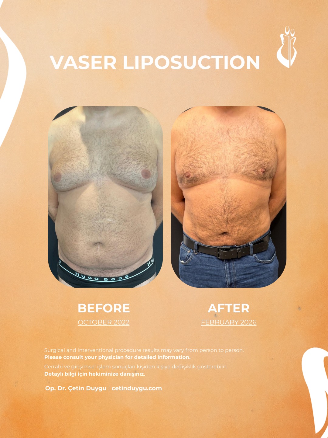 WhatsApp Image 2026-02-09 at 17.59.32